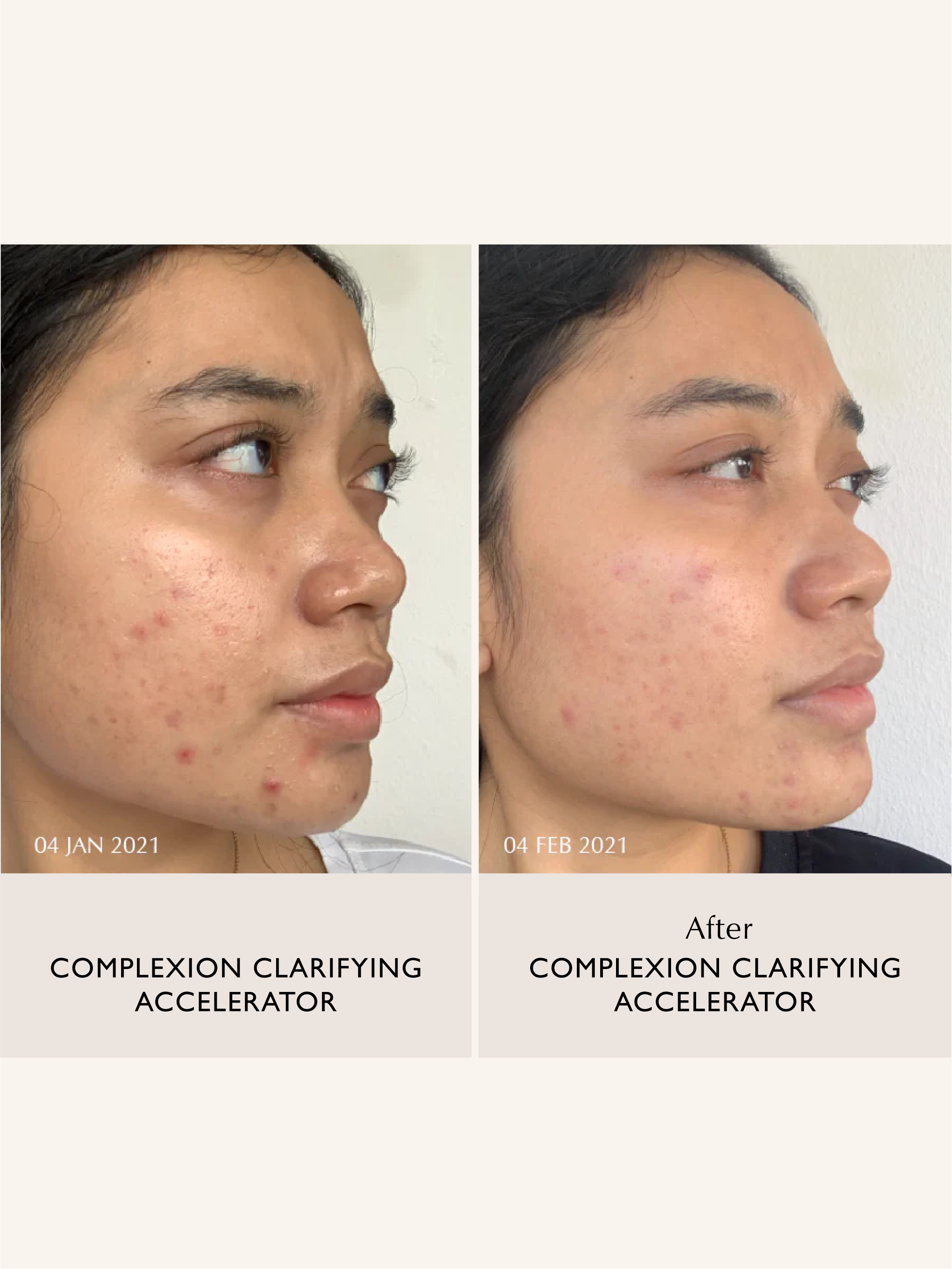 Sachi Skin - Wholesale Facial Serum/Concentrate - Complexion Clarifying Accelerator - 30ml7