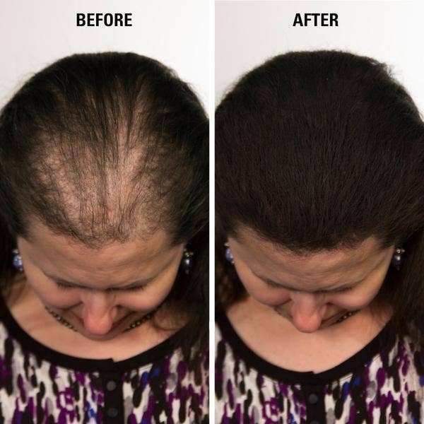 My Wholesale Warehouse - Wholesale Hair Thinning/Loss Treatment - Volumon Hair Building Fibres - KERATIN 12g