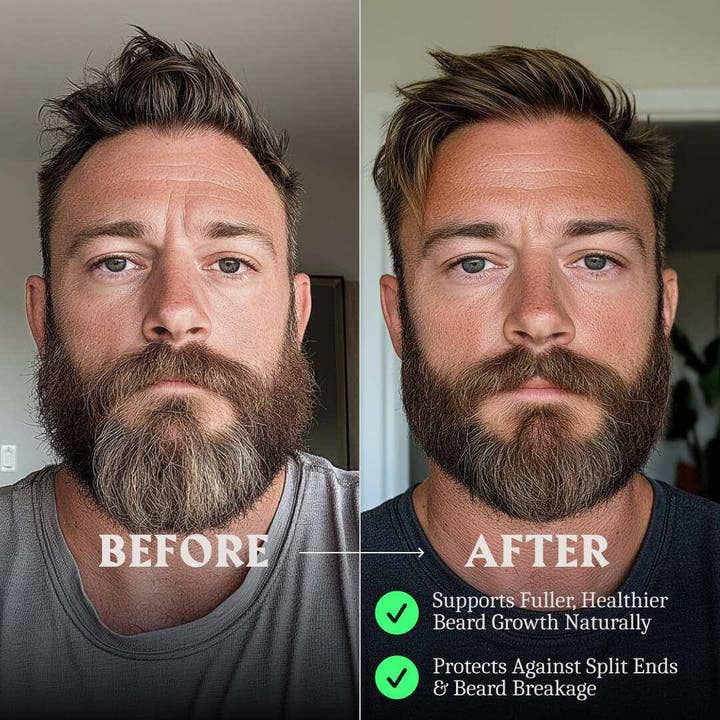 Striking Viking - Wholesale Baardstylingproduct - Baardgroeiolie Biotine voor Mannen - Geurloos7