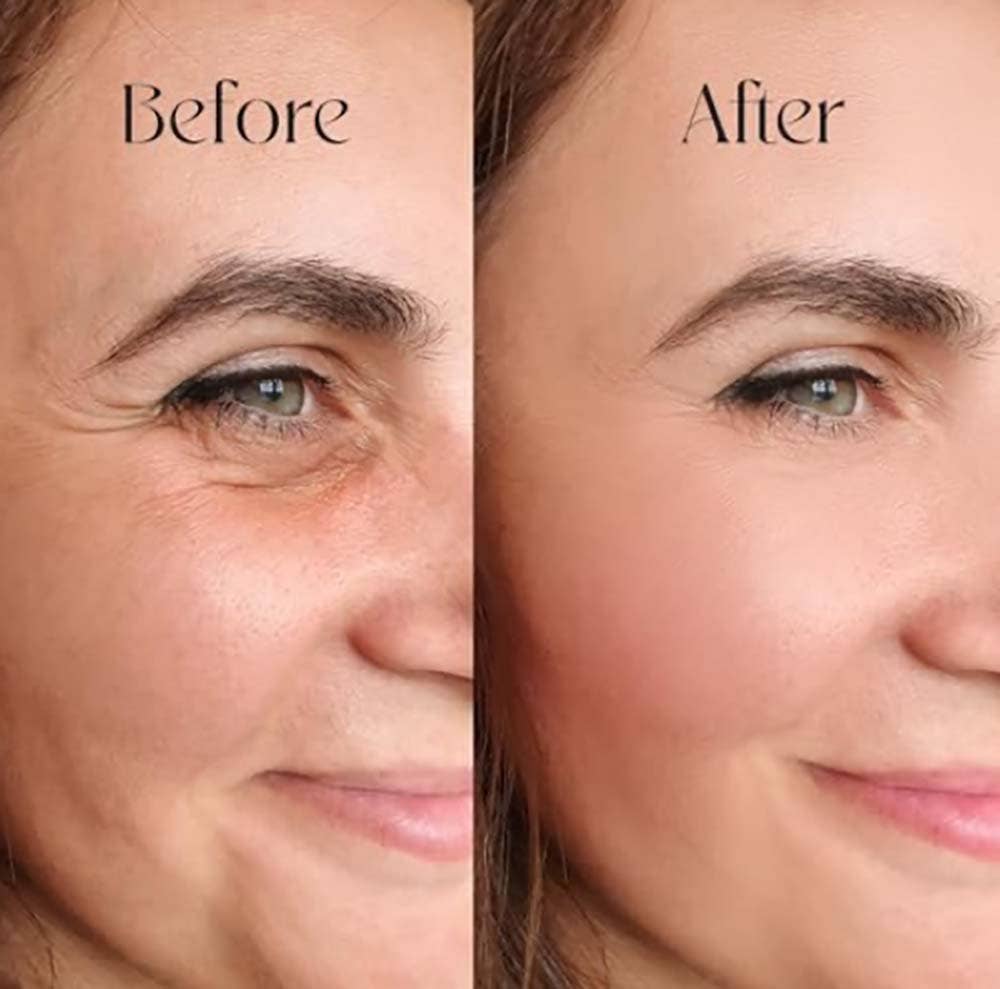 Skin Centrick - Wholesale Facial Moisturizer - Hyaluronic Acid Serum1