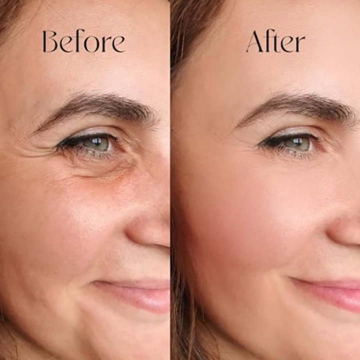 Skin Centrick - Wholesale Facial Moisturizer - Hyaluronic Acid Serum1