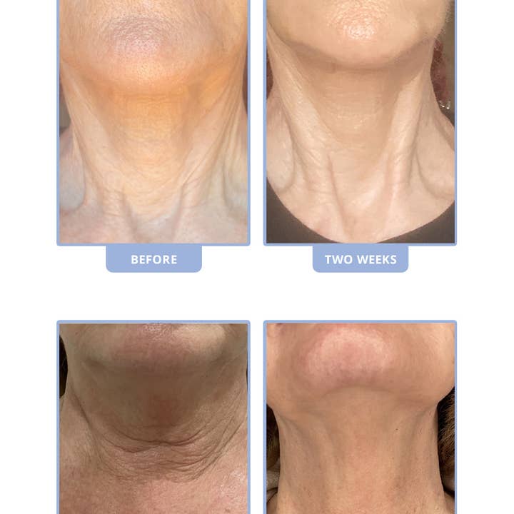 Stemulation Skin Care - Wholesale Anti-Aging Moisturizer - Diamond Neckless lifts and tightens the sagging neck skin