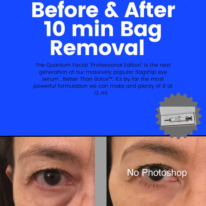 NABulous - Wholesale Anti-aging moisturiser - Better than Botox™ Anti-Aging Serums Under Eye Wrinkles, Forehead and Professional Edition38