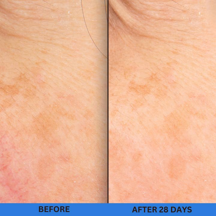 skin magic - Wholesale Facial Toner - 10% Glycolic Treatment Tonic