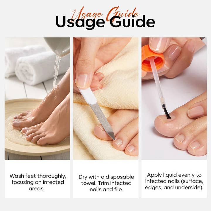 Modelones - Wholesale Cuticle Oil - Nail Antifungal Treatment2