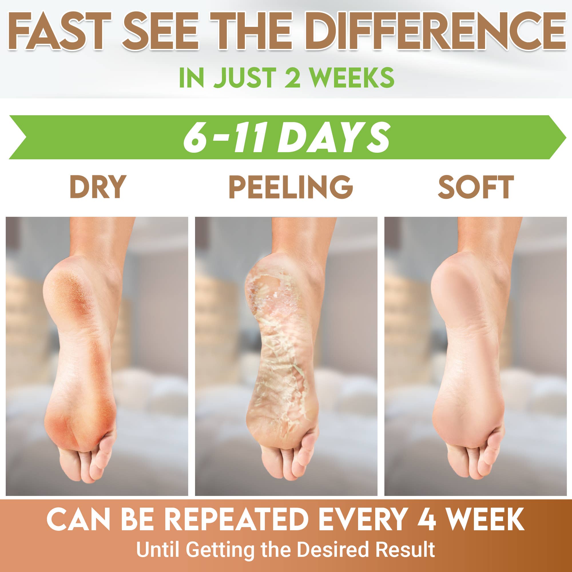 Karma Organic spa - Wholesale Foot Mask - Foot Peel Mask 2 Pack –Coconut Peeling Mask 100% Organic1