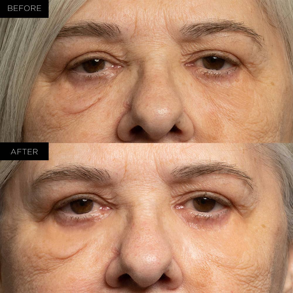 Endure Beauty – wholesale Eye treatment mask – Endure Under Eye Therapy Gel Pads - Renewing1