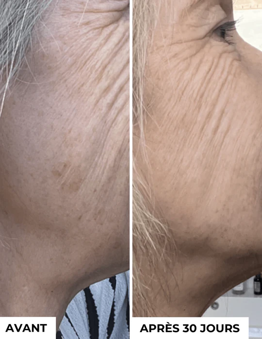 DERMEDEN - Venta al por mayor Sérum facial - Concentrado anti-manchas oscuras3