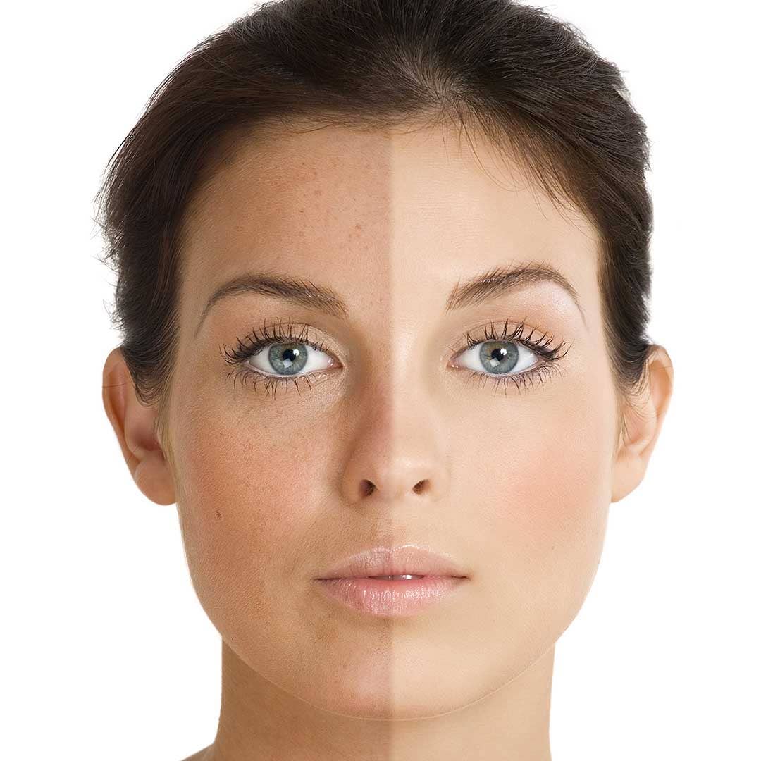 eGlobal Beaute – Engroshandel Ansigtsserum – Magnolia Orchid α-Arbutin Advanced Radiance-koncentrat3