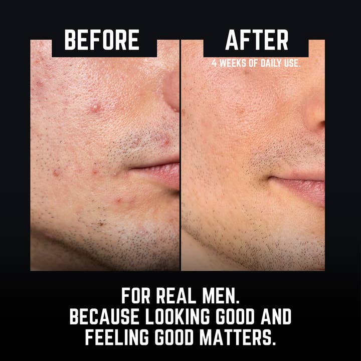 Moes Group - Wholesale Facial Moisturizer - Whipped Beef Tallow Body and Face Balm- Titan Tallow6