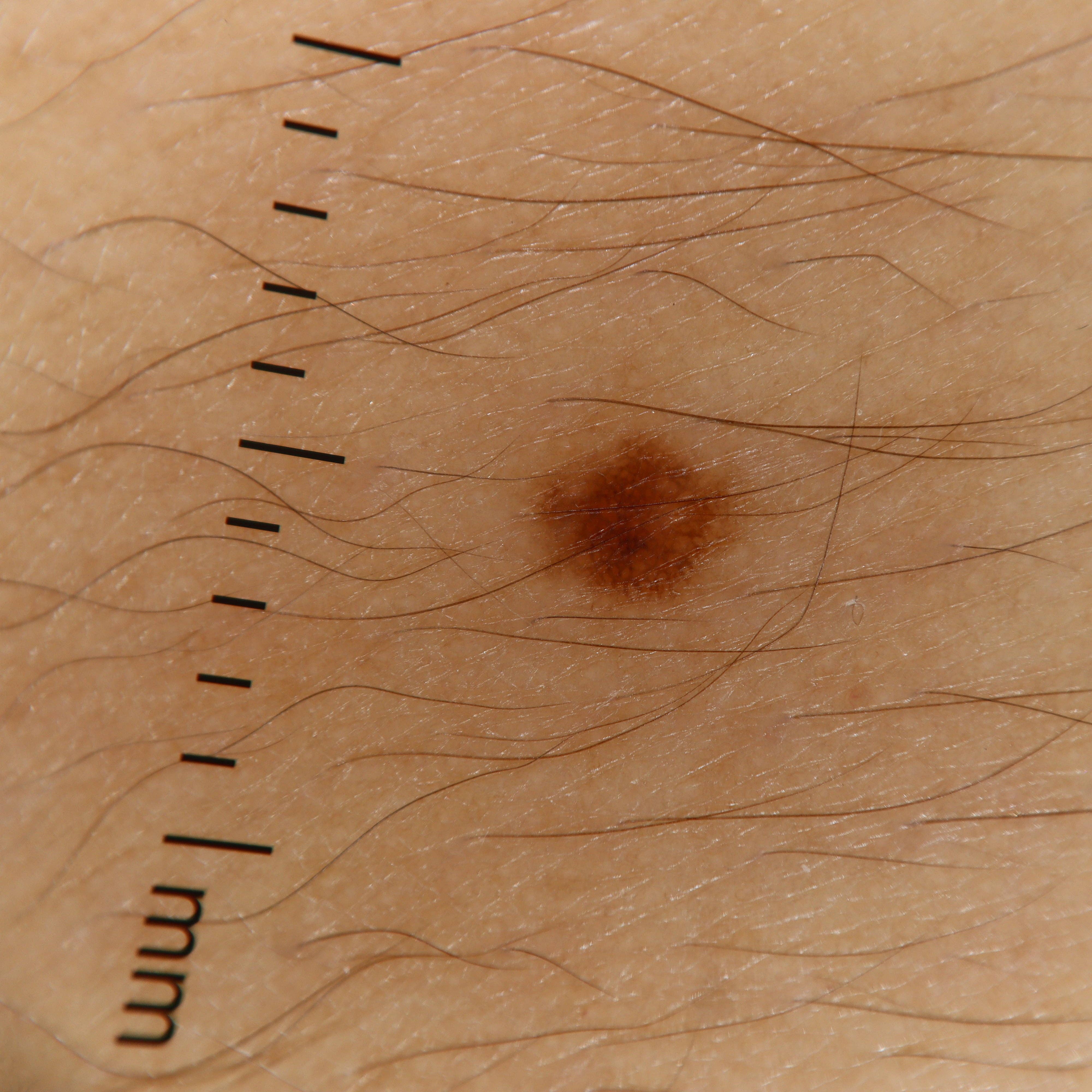 IBOOLO - Wholesale Electronic Skincare Device - IBOOLO DE-4100 PRO functional handheld brightness adjustment dermatoscope for naked eye examine6