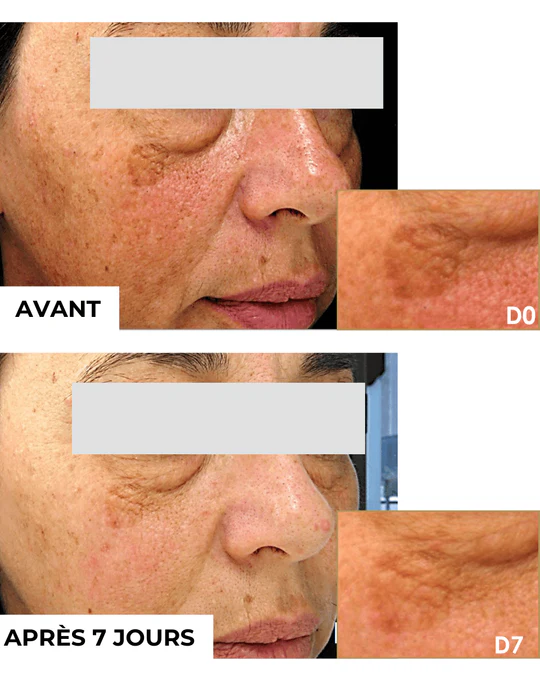 DERMEDEN - Wholesale Eye Cream/Gel - Intense Eye Contour2