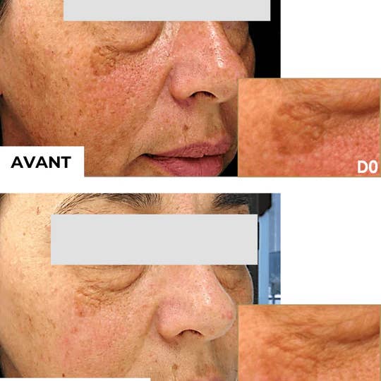 DERMEDEN - Wholesale Eye Cream/Gel - Intense Eye Contour2