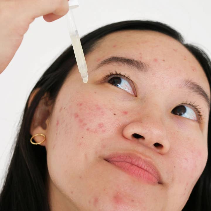 cocokind - Wholesale Facial Serum/Concentrate - Postbiotic Acne Serum3