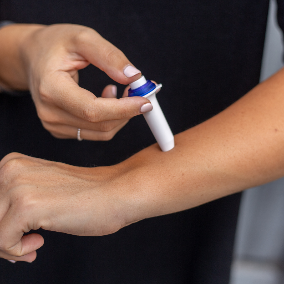 Mozzigear - Wholesale Insect repellent - Mozzigear Mosquito Click Eliminate Irritation1