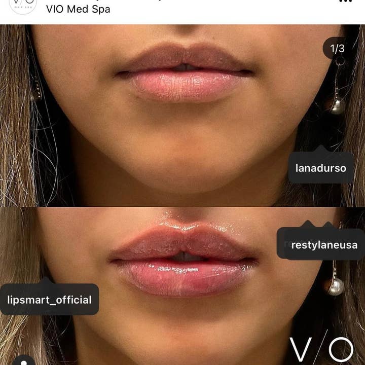 Lipsmart – wholesale Läppbehandling/Mask – Lipsmart återfuktande läppbehandlingar (12 enheter)