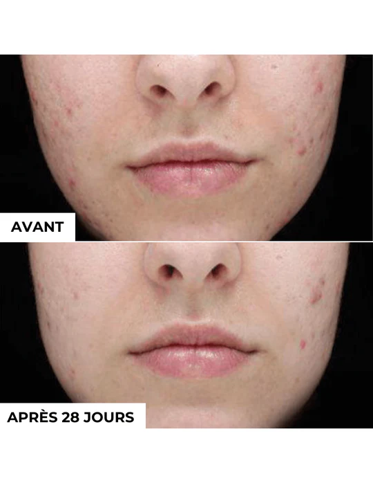 DERMEDEN - Vente Nettoyants pour le visage - Gel nettoyant purifiant2