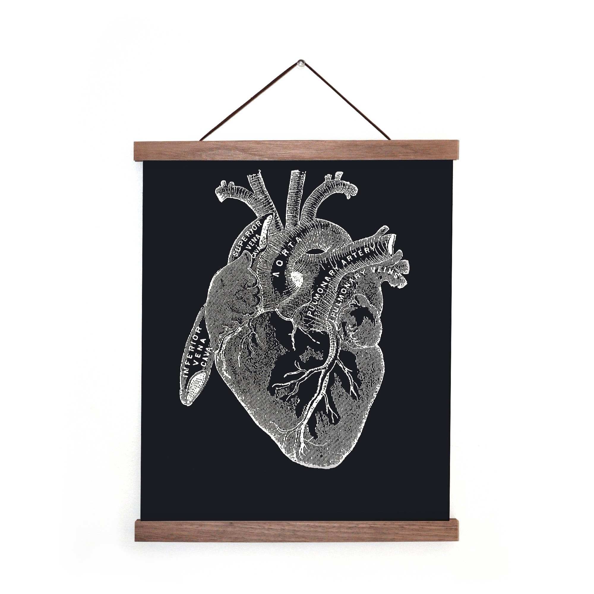 Curious Prints - Wholesale Art Print - Vintage Anatomy Heart Diagram Black Print w/ optional frame2