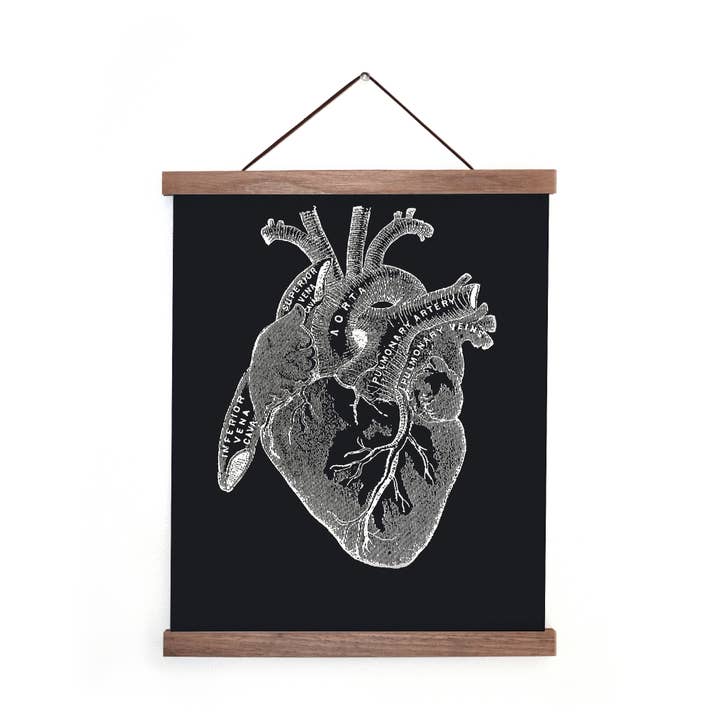 Curious Prints - Wholesale Art Print - Vintage Anatomy Heart Diagram Black Print w/ optional frame2