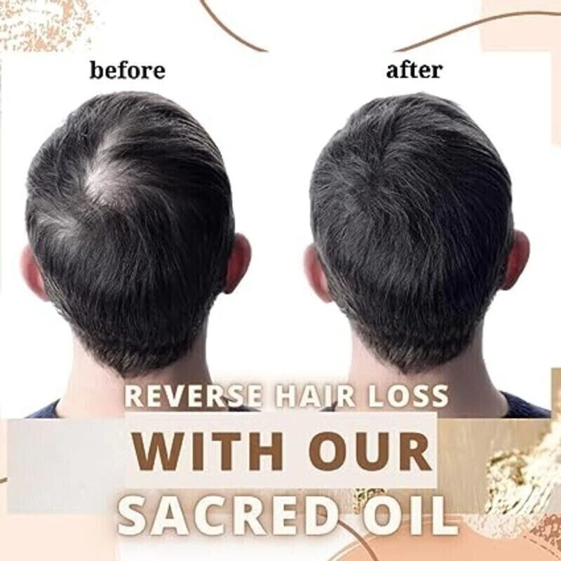 Au Natural Organics – wholesale Hair oil – Bulk Pure Batana Oil for Hair Growth Supplier Honduras 1 ltr1