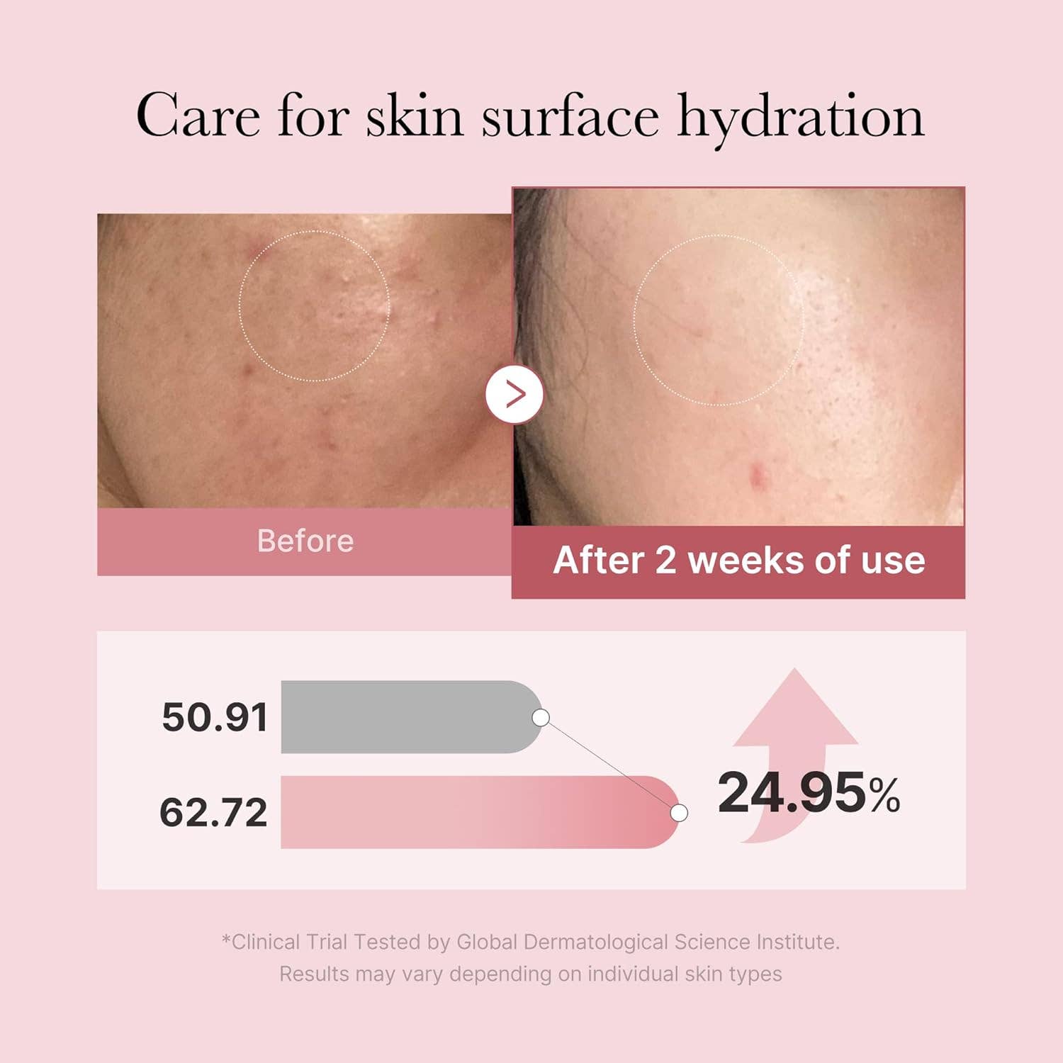 MEHIAZ - Wholesale Facial Serum/Concentrate - medicube Pink Glutathione Spray Serum – Radiant Skin 3.38oz1