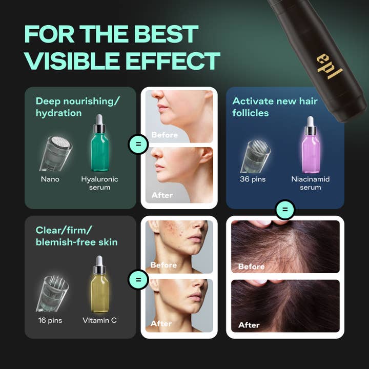 Wonder Family - Wholesale Electronic Skincare Device - Premium Microneedling Pen for Face and Body with 16 Cartridg4