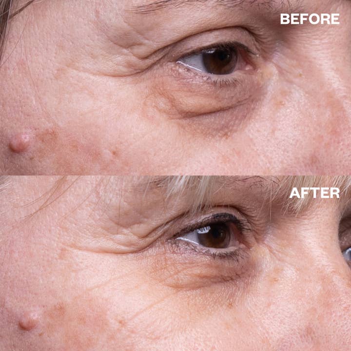 Wrinkles Schminkles - Wholesale Eye Treatment Mask - Eye Wrinkle Patches - One Pair