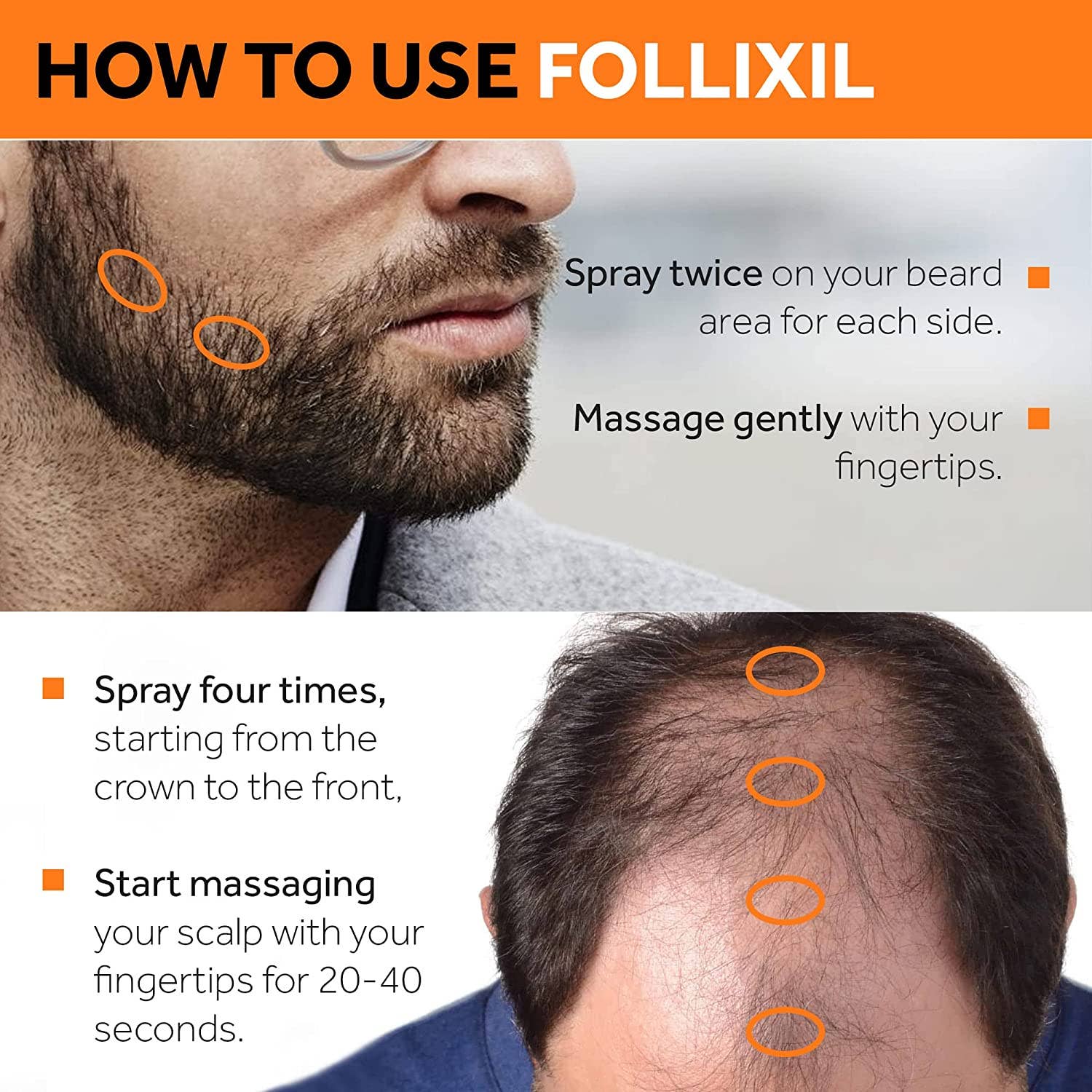 Matykos Beauty LLC - Wholesale Hair Thinning/Loss Treatment - FOLLIXIL 5% Minoxidil Lotion with Biotin and Capilia Longa1