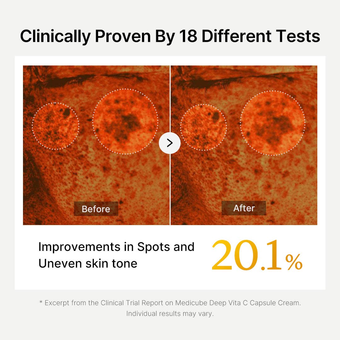 SKEEN – wholesale Ansiktsfuktkräm – MEDICUBE Deep Vita C Kapselkräm 55g5