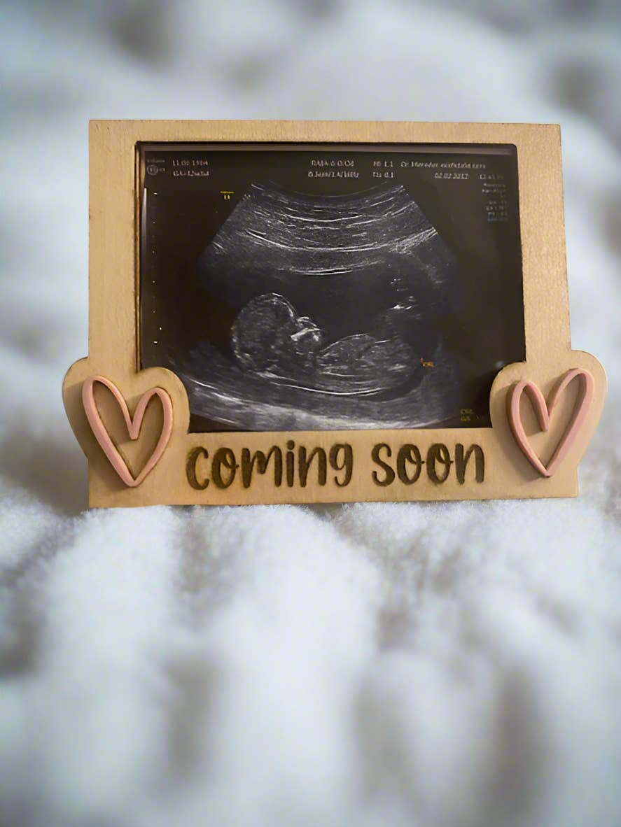 Vance Custom Creations - Wholesale Picture Frame - Kids & Baby - Ultrasound Fridge Magnets1