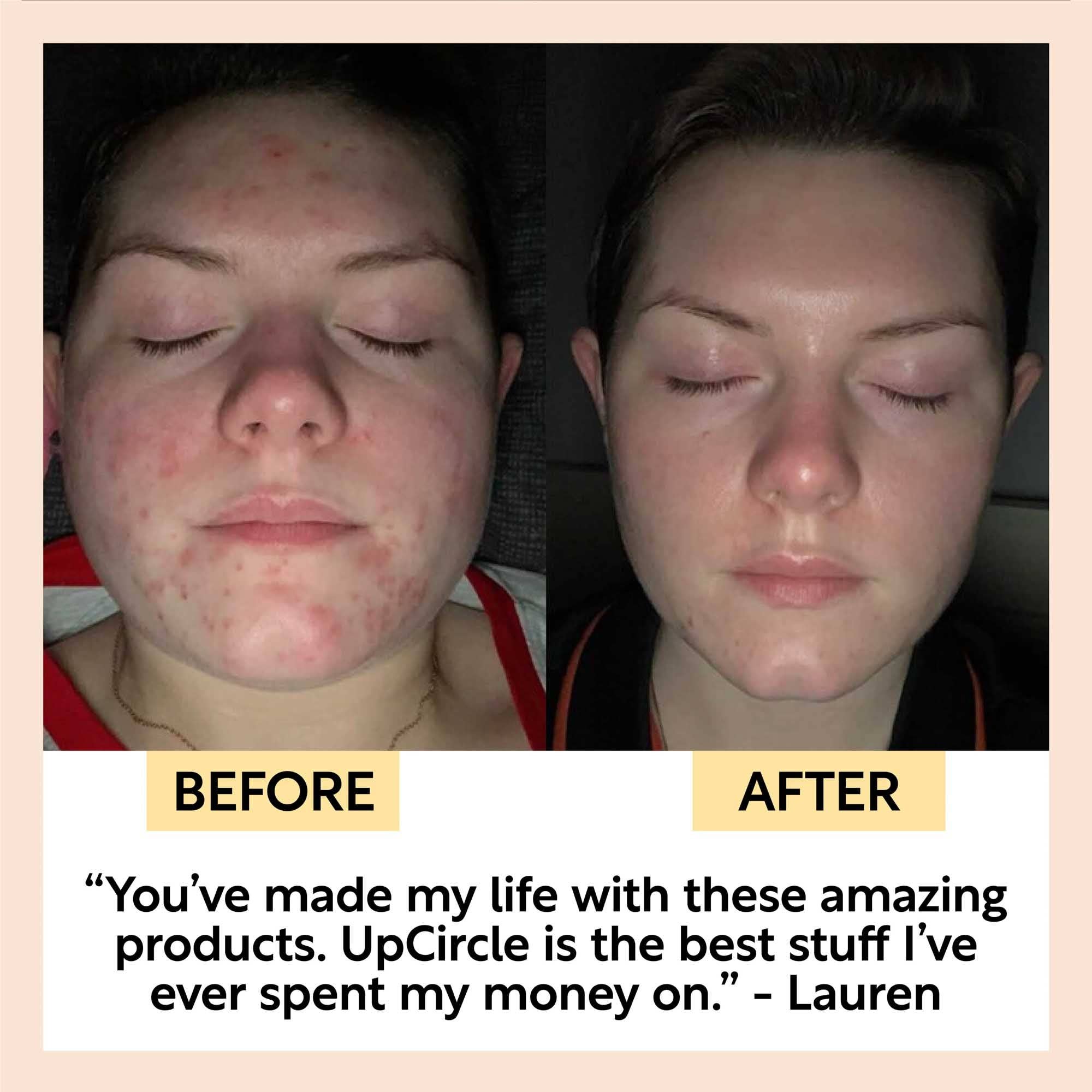 VIAI Beauty - Wholesale Facial Cleanser - UPCIRCLE Double Cleansing Duo7