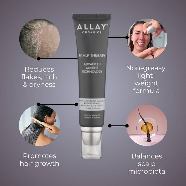 Allay Organics - Wholesale Scalp/Hair Treatment - Scalp Therapy- Leave In Treatment for Psoriasis Prone Scalp2