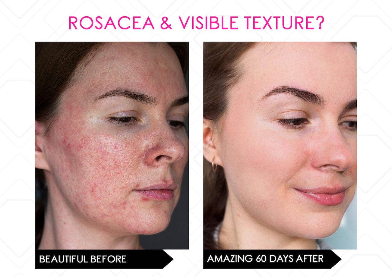 Mirenesse - Wholesale Electronic Skincare Device - LED Multi Light Therapy Mask, Electronic Skincare Device12