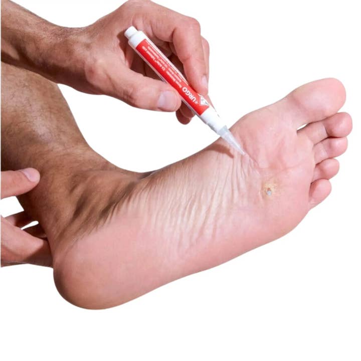 My Podologie - Vendita all'ingrosso Crema piedi - Penna per il trattamento delle verruche resistenti - 2 ml - Urgo1