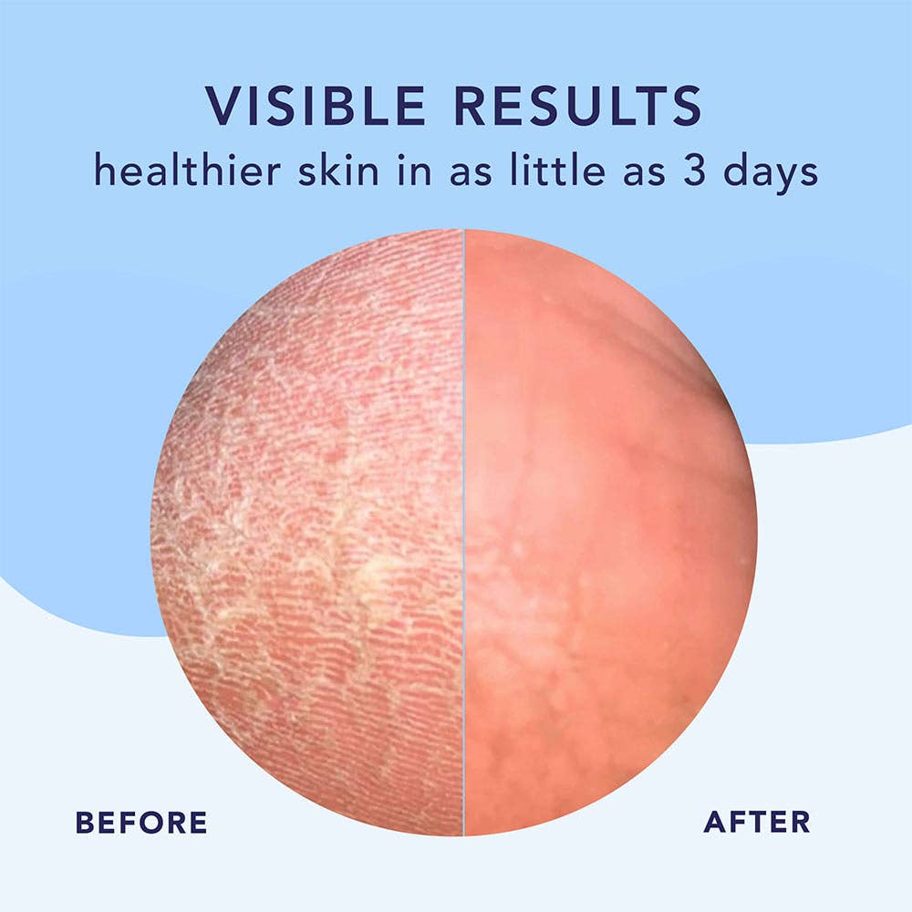 Barefoot Scientist - Wholesale Foot Cream - High Dive | Intensive hydration for smoother feet3