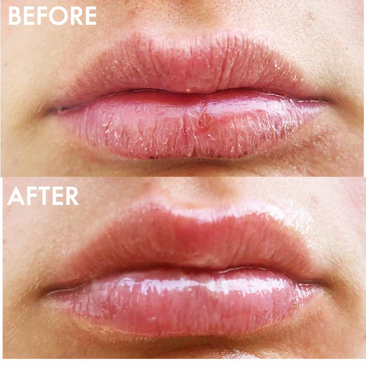 Lanolips - Wholesale Lip Balm - The Original 101 Ointment Multipurpose Superbalm6