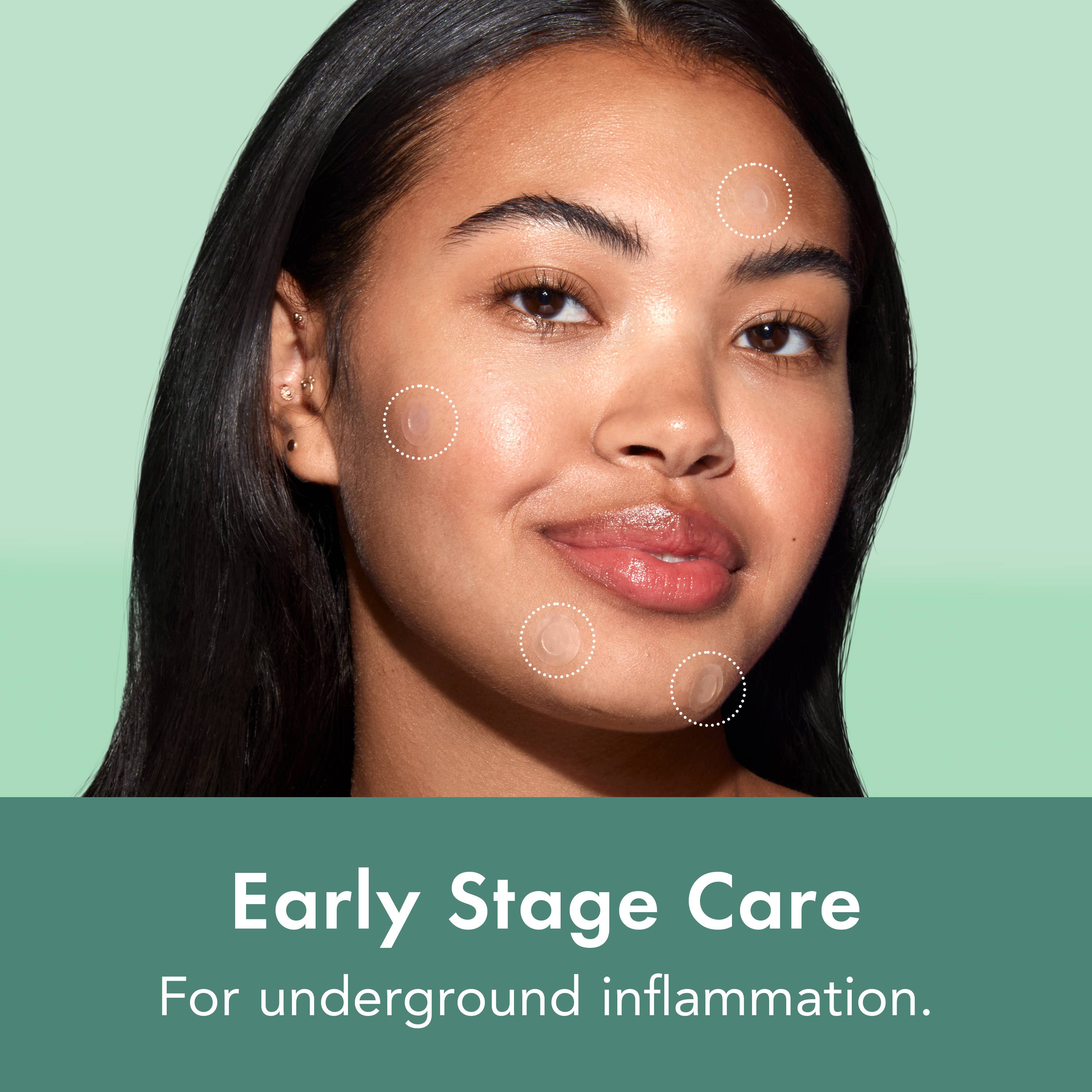 Rael - Wholesale Acne/Hydrocolloid Patch - Rael Miracle Patch Microcrystal Spot Cover - Pimples, Acne3