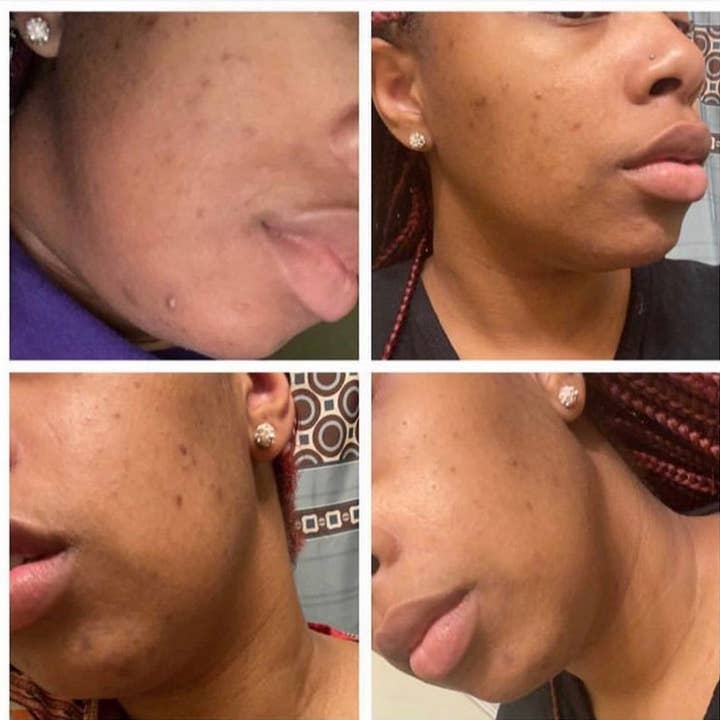 Bare Organics Lux Skincare – Engroshandel Sæbestykke – Gurkemeje lysere sæbe, C-vitamin sæbe, Alpha Arbutin Ski1