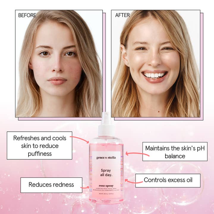 Grace & Stella Co - Venta al por mayor Agua/bruma facial y corporal - Spray Tonificador Facial de Agua de Rosas (240 ml)5