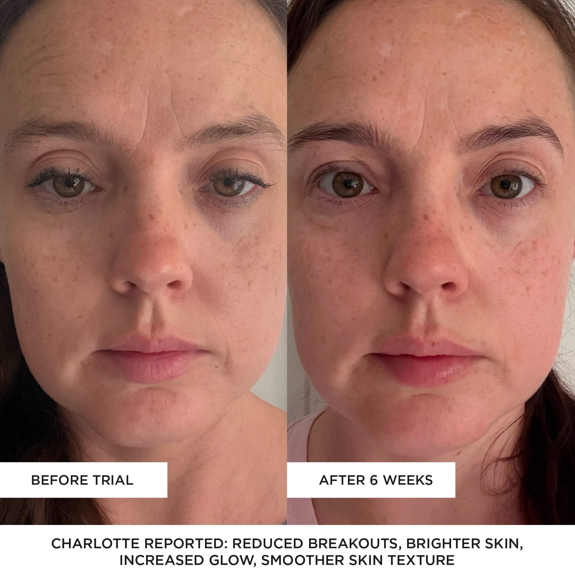 BEAUTYPRO – wholesale Skincare face mask – PHOTON LED Light Therapy Facial Mask12