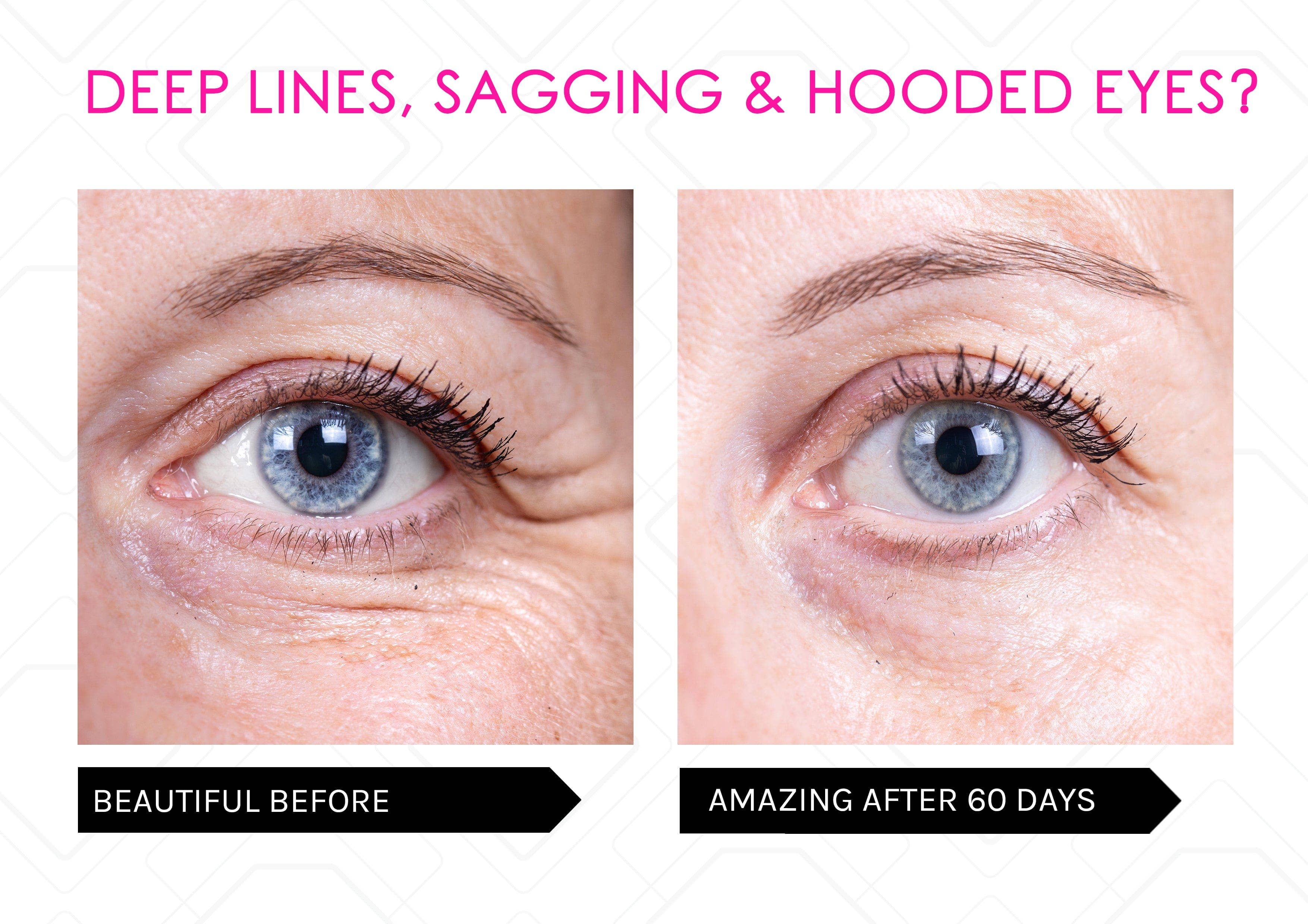 Mirenesse - Wholesale Skincare Face Mask - Skin Secrets Red LED Mask, 7 in 1 Treatments21