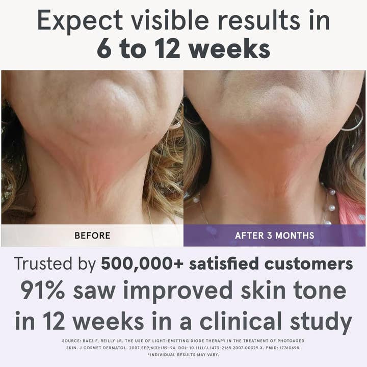 iRESTORE - Wholesale Skincare Face Mask - iRESTORE LED Face Mask Light Therapy | Blue, Infrared & Red 4