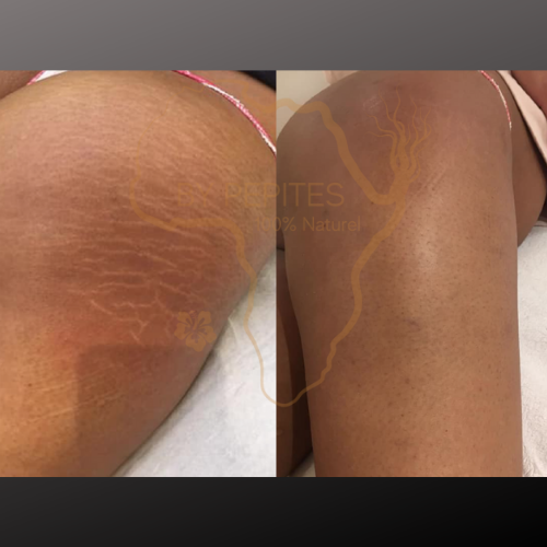 BY PEPITES - Wholesale Belly Oil/Butter - Maternity - Lanta BAUME deeply treats stretch marks and damaged skin.1