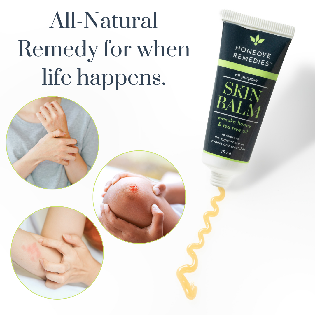 Honeoye Remedies - Wholesale Healing Salve/Balm/Cream - Skin Balm [ 15 ml] | Manuka Honey [550+MGO] & Tea Tree Oil2