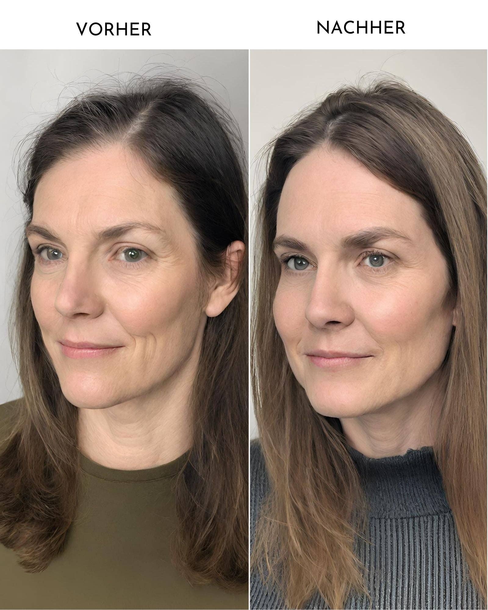 ELLENITY – wholesale Hair serum – Haarwachstums-Booster Kopfhautmassage-Set3