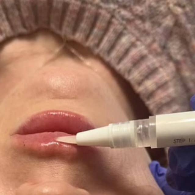 Aesthetic Aftercare - Wholesale Lip Balm - Aesthetic Aftercare Lip Kit for Post Lip Injection - 2 steps1