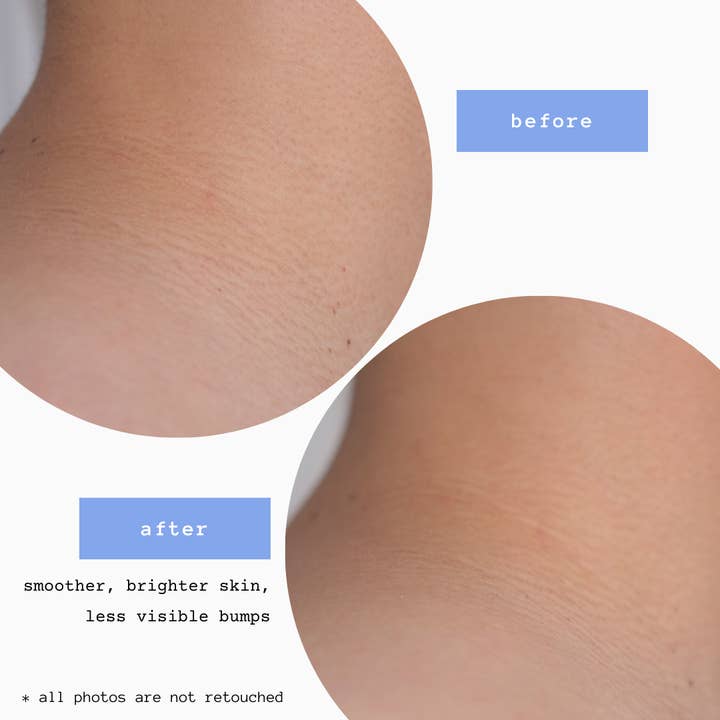 Sende Body-Care Essentials - Wholesale Exfoliating Gloves/Mitts - Body Exfoliating Kese Mitt | Normal to Rough Skin w/Elastic5