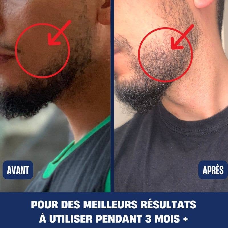 La Douce barbe - Wholesale Electronic Skincare Device - Dermaroller2