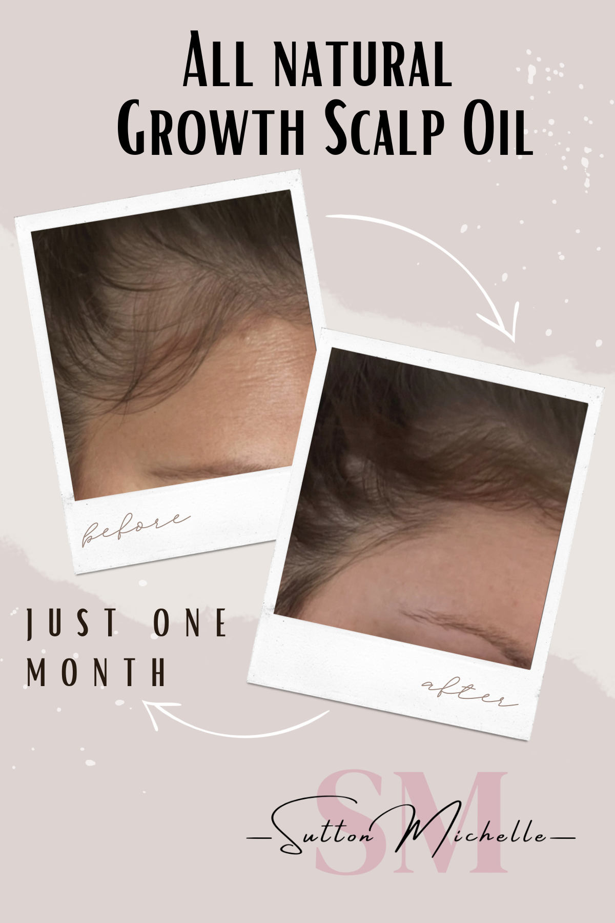 Sutton Michelle Designs - Wholesale Hair Oil - Growth Scalp Oil3