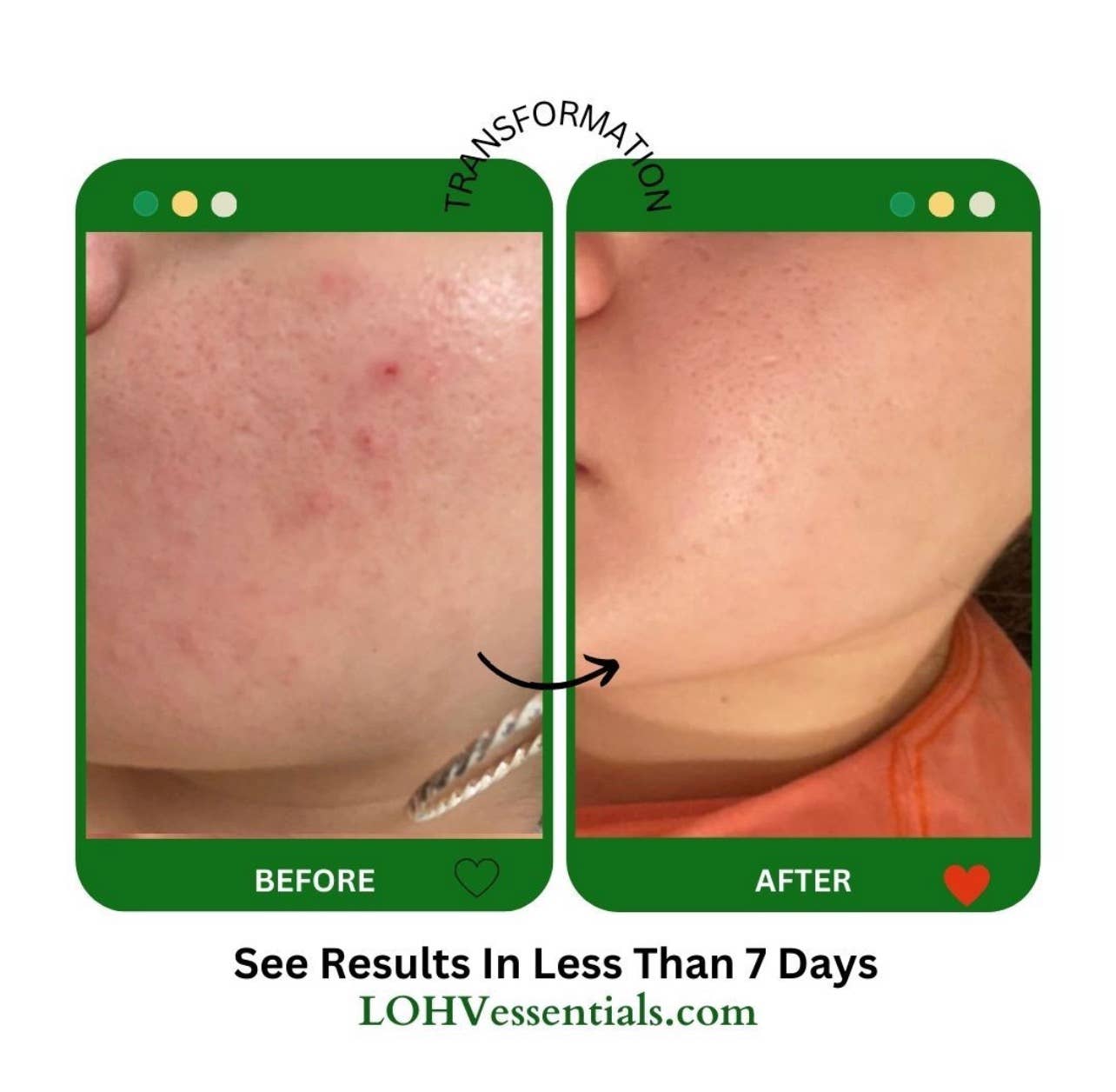 LOHV ESSENTIALS - Wholesale Facial Cleanser - PREMIUM 100% VEGAN CLEANSE THE DAY AWAY Face Cleanser with Hyaluronic Acid + Lactic Acid + Glycolic Acid Face Cleanser4